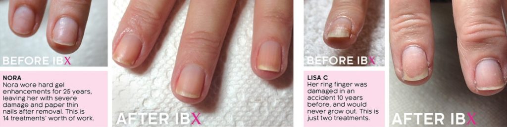 Famous Names IBX repair and strengthening treatment system manchester city centre before after
