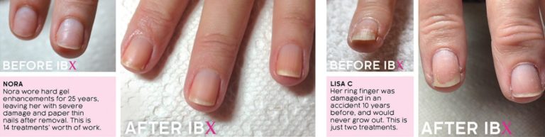 Famous Names IBX repair and strengthening treatment system manchester city centre before after
